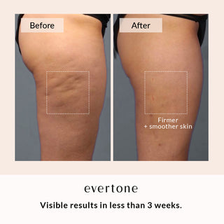Anti-Cellulite Cream/Body Shaper + Gua Sha Tool Set