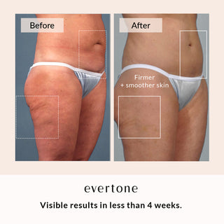 Anti-Cellulite Coffee Scrub/Body Exfoliator