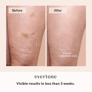 Anti-Cellulite Body Mask/Body Firmer