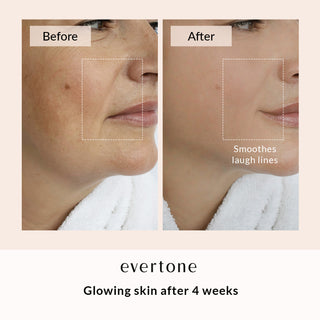 Red Light + Microcurrent Mask/LED Face & Neck MASK