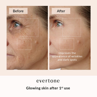 Glow Booster Bundle/Microcurrent Toning Device + LED Mask + Infrawave Wand + Serum