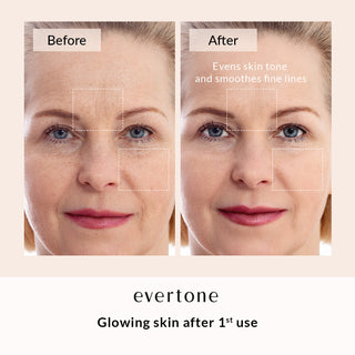 Skin Rejuvenation Bundle/Microcurrent Device + LED Mask + Serum
