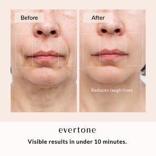 Lift + Glow Bundle /Microcurrent Toning Device + Red Light Therapy Wand + Activating Serum