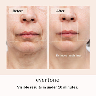 Glow Booster Bundle/Microcurrent Toning Device + LED Mask + Infrawave Wand + Serum