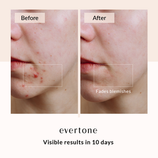 Glow Booster Bundle/Microcurrent Toning Device + LED Mask + Infrawave Wand + Serum