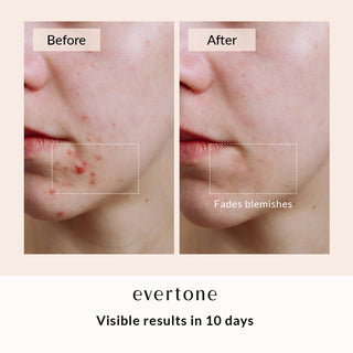 Lift + Glow Bundle /Microcurrent Toning Device + Red Light Therapy Wand + Activating Serum