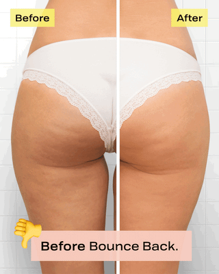 how to get rid of cellulite on Butt - Evertone Skin